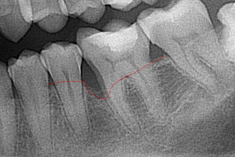 parodontológia tasak