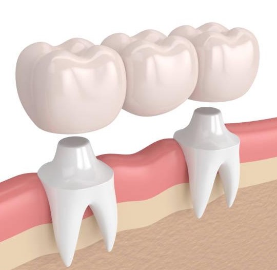 Fogpotlas Lehetosegek