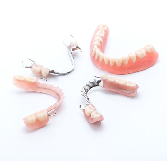 Kivehető Fogpótlások