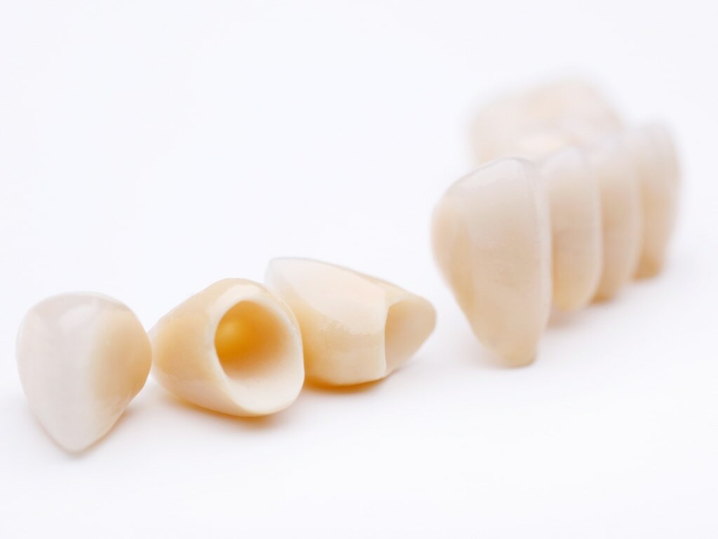 Rögzített Fogpótlások